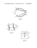 TISSUE CLAMP FOR NONINVASIVE PHYSIOLOGICAL MEASUREMENT diagram and image