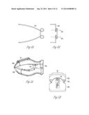 TISSUE CLAMP FOR NONINVASIVE PHYSIOLOGICAL MEASUREMENT diagram and image