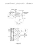 DEVICES AND METHODS FOR TISSUE NAVIGATION diagram and image