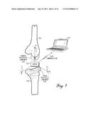 Prosthetic Knee Joint Measurement System Including Energy Harvesting And     Method Therefor diagram and image