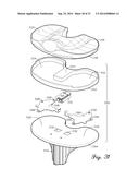 Prosthetic Knee Joint Measurement System Including Energy Harvesting And     Method Therefor diagram and image