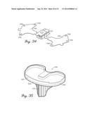 Prosthetic Knee Joint Measurement System Including Energy Harvesting And     Method Therefor diagram and image