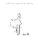 Prosthetic Knee Joint Measurement System Including Energy Harvesting And     Method Therefor diagram and image