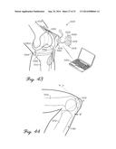 Prosthetic Knee Joint Measurement System Including Energy Harvesting And     Method Therefor diagram and image