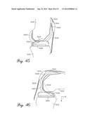 Prosthetic Knee Joint Measurement System Including Energy Harvesting And     Method Therefor diagram and image