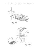 Prosthetic Knee Joint Measurement System Including Energy Harvesting And     Method Therefor diagram and image