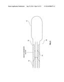 OCCLUSION RESISTANT CATHETER AND METHOD OF USE diagram and image