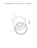 OCCLUSION RESISTANT CATHETER AND METHOD OF USE diagram and image