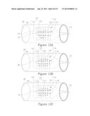 LESION TREATMENT DEVICE AND METHODS FOR TREATING LESIONS diagram and image