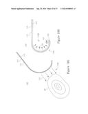 LESION TREATMENT DEVICE AND METHODS FOR TREATING LESIONS diagram and image