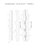 LESION TREATMENT DEVICE AND METHODS FOR TREATING LESIONS diagram and image