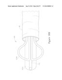 LESION TREATMENT DEVICE AND METHODS FOR TREATING LESIONS diagram and image