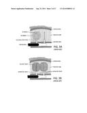 SYSTEMS AND METHODS FOR PROSTATE TREATMENT diagram and image