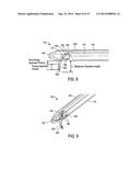 SYSTEMS AND METHODS FOR PROSTATE TREATMENT diagram and image