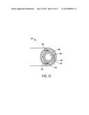 SYSTEMS AND METHODS FOR PROSTATE TREATMENT diagram and image