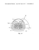 SYSTEMS AND METHODS FOR PROSTATE TREATMENT diagram and image