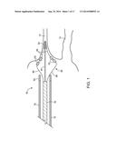 ABLATION CATHETER diagram and image