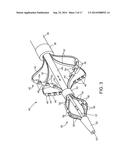 ABLATION CATHETER diagram and image