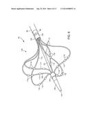 ABLATION CATHETER diagram and image