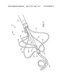 ABLATION CATHETER diagram and image