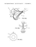 ABLATION CATHETER diagram and image