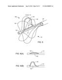 ABLATION CATHETER diagram and image