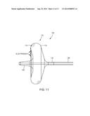 ABLATION CATHETER diagram and image