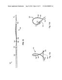 ABLATION CATHETER diagram and image