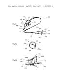 ABLATION CATHETER diagram and image