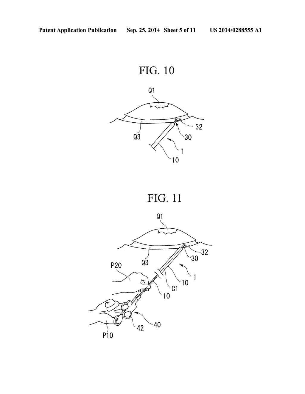 MEDICAL TREATMENT INSTRUMENT - diagram, schematic, and image 06