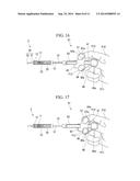 MEDICAL TREATMENT INSTRUMENT diagram and image