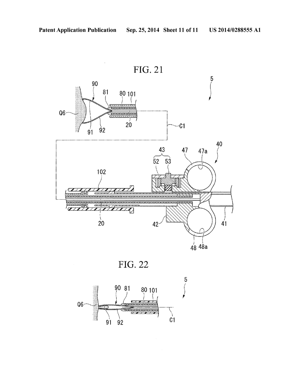 MEDICAL TREATMENT INSTRUMENT - diagram, schematic, and image 12