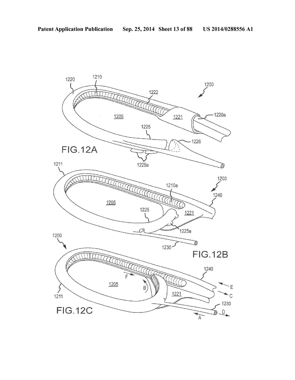 CARDIAC ABLATION SYSTEMS AND METHODS - diagram, schematic, and image 14