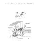 System and method for performing measurable and controled osteotomy diagram and image