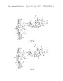 KNEE ARTHROPLASTY INSTRUMENT diagram and image