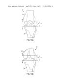 KNEE ARTHROPLASTY INSTRUMENT diagram and image