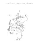 KNEE ARTHROPLASTY INSTRUMENT diagram and image