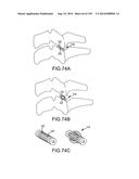 VERTEBRAL JOINT IMPLANTS AND DELIVERY TOOLS diagram and image