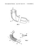 SHAPE-TRANSFERRING CANNULA SYSTEM AND METHOD OF USE diagram and image