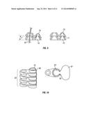 SHAPE-TRANSFERRING CANNULA SYSTEM AND METHOD OF USE diagram and image