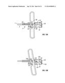 SHAPE-TRANSFERRING CANNULA SYSTEM AND METHOD OF USE diagram and image