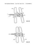 SHAPE-TRANSFERRING CANNULA SYSTEM AND METHOD OF USE diagram and image