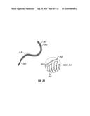 SHAPE-TRANSFERRING CANNULA SYSTEM AND METHOD OF USE diagram and image