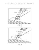 REPLACEABLE TIP SUTURING DEVICES, SYSTEM, AND METHODS FOR USE WITH     DIFFERING NEEDLES diagram and image