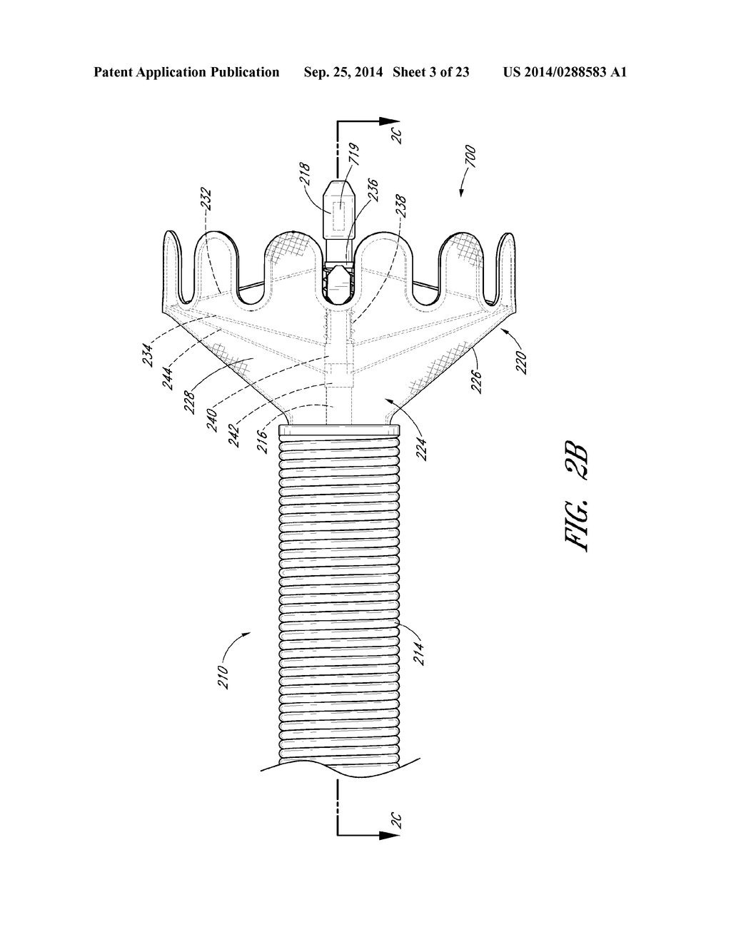 VASCULAR PLAQUE REMOVAL SYSTEMS, DEVICES, AND METHODS - diagram, schematic, and image 04