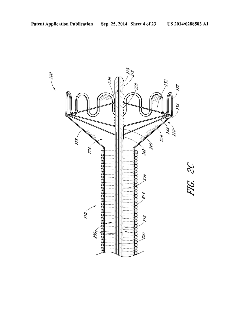 VASCULAR PLAQUE REMOVAL SYSTEMS, DEVICES, AND METHODS - diagram, schematic, and image 05