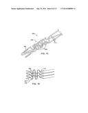 Apparatus and Methods for Treating Hardened Vascular Lessions diagram and image