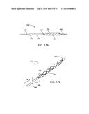 Apparatus and Methods for Treating Hardened Vascular Lessions diagram and image