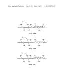 Apparatus and Methods for Treating Hardened Vascular Lessions diagram and image