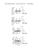 APPARATUS AND METHODS FOR POSITIONING AND SECURING ANCHORS diagram and image